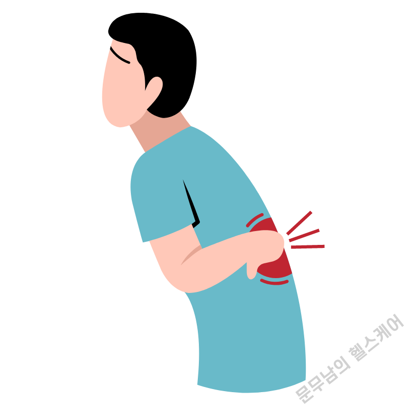 꼬리뼈 통증 원인 증상 치료법