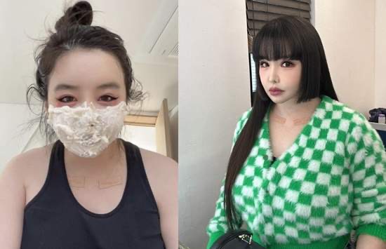 박봄