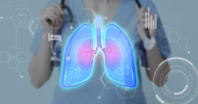 마이코플라스마 폐렴