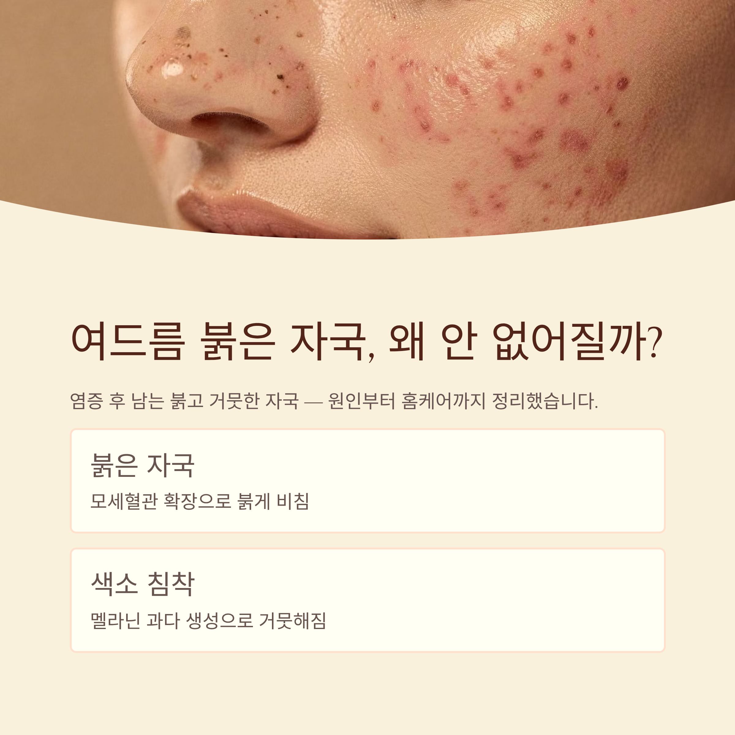 붉은 자국