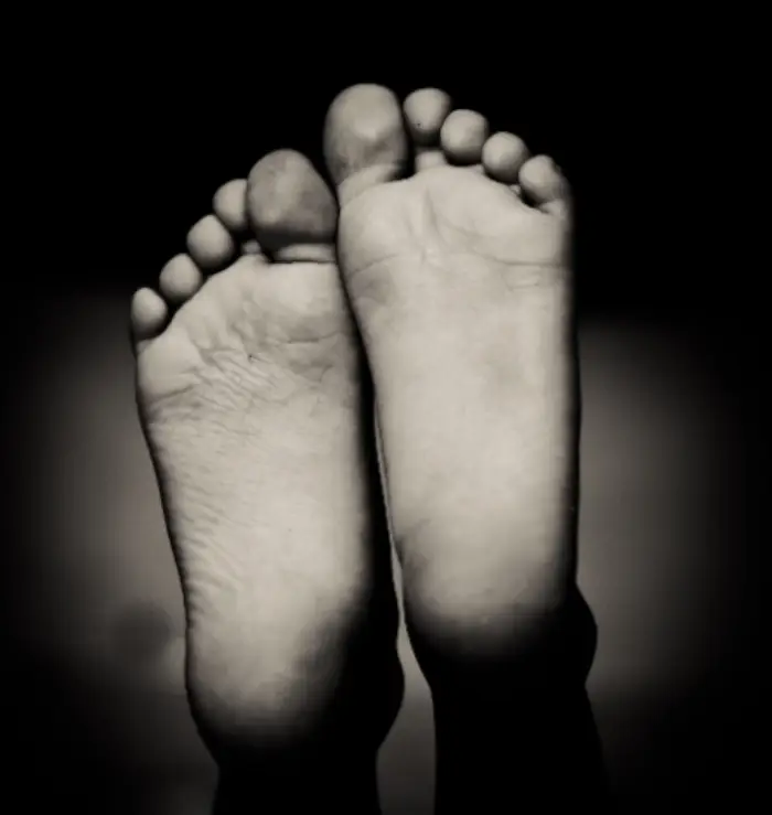 파상풍 예방접종 가격