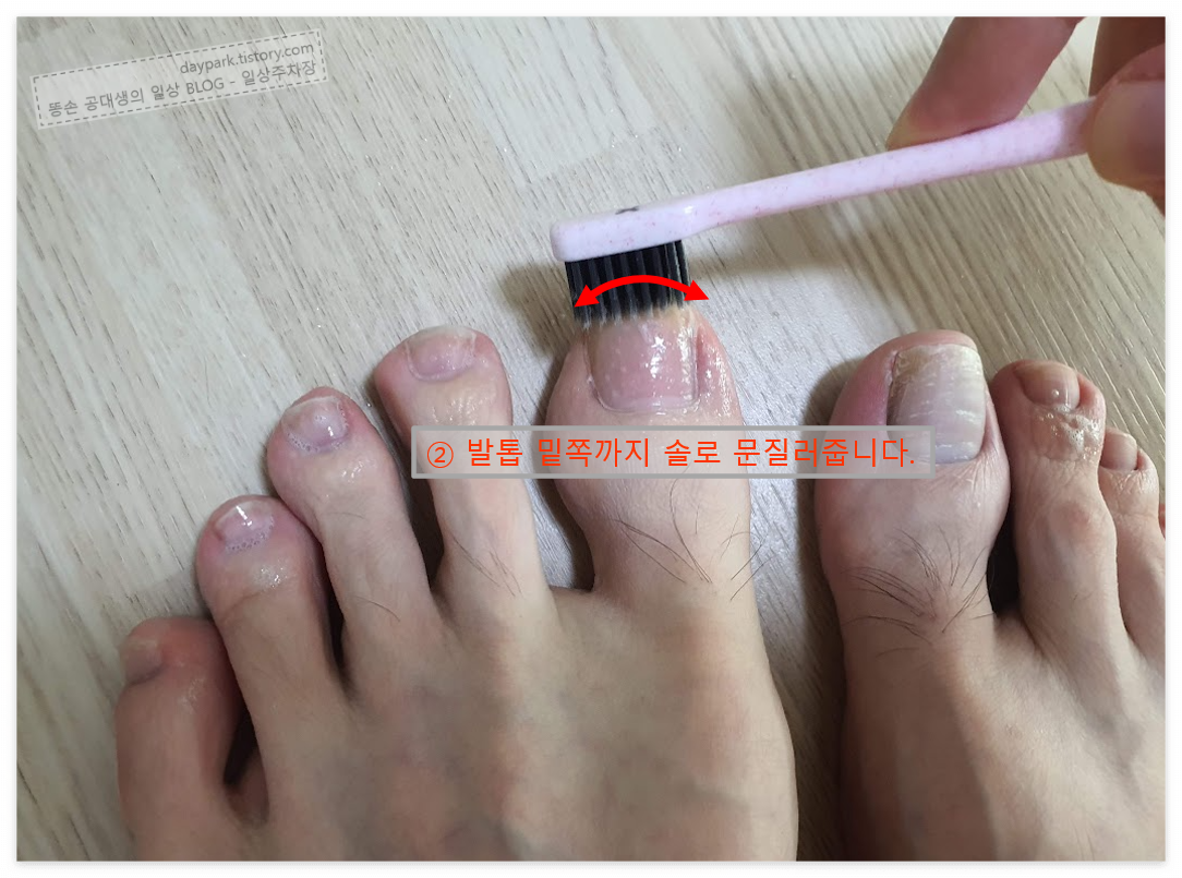 발톱 밑에 칫솔질