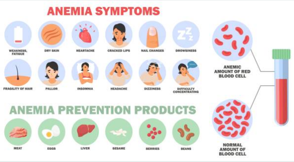 빈혈에 좋은 음식