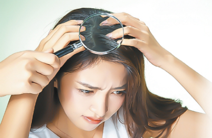 20~30대 탈모 초기 증상