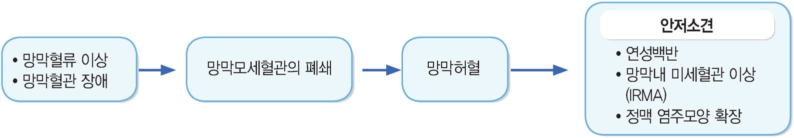 당뇨망막병증