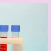 마그네슘 부족현상에 좋은 영양제 TOP3 비교분석