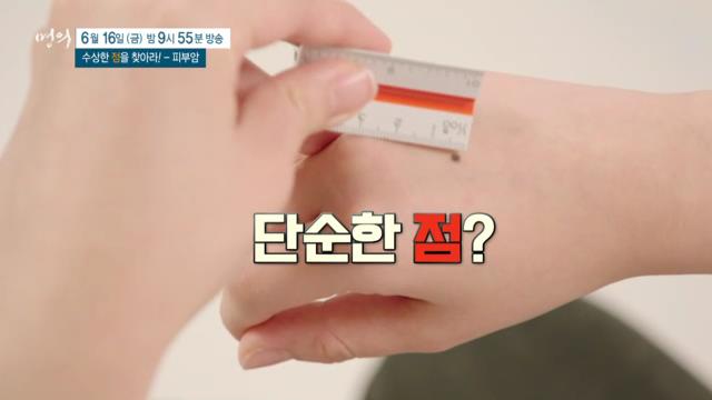 명의 수상한 '점'을 찾아라, 피부암, 악성 흑색종, 예방, 치료 방법