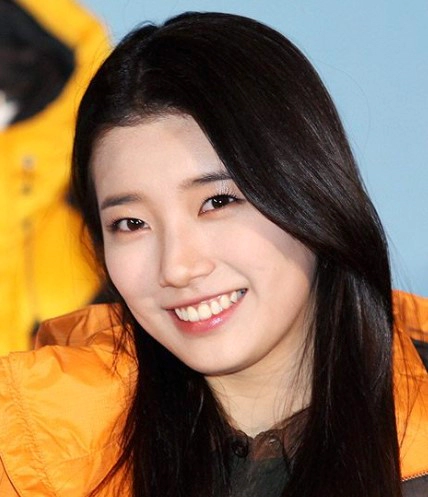 임플란트 후 교정 김태희 수지 효과
