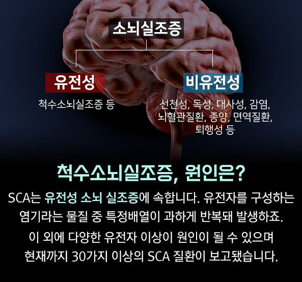 소뇌위축증