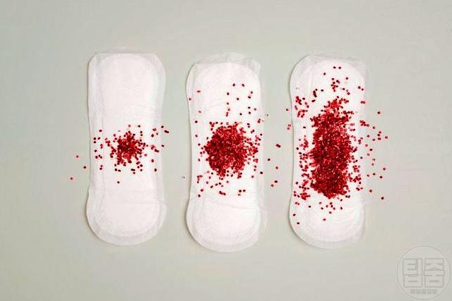 자궁경부암 초기증상 질 출혈