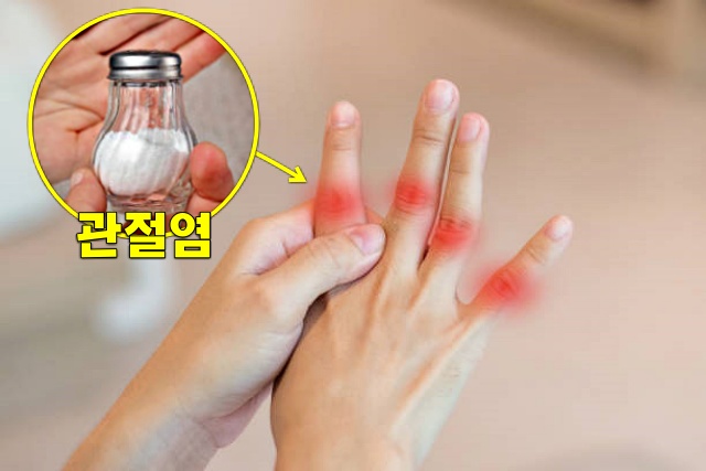 관절염 통증 소금 섭취량 나트륨 과다섭취, 건강 팁줌 매일꿀정보