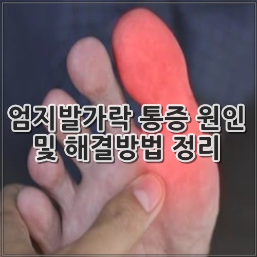 엄지발가락 통증 원인 및 해결방법 정리
