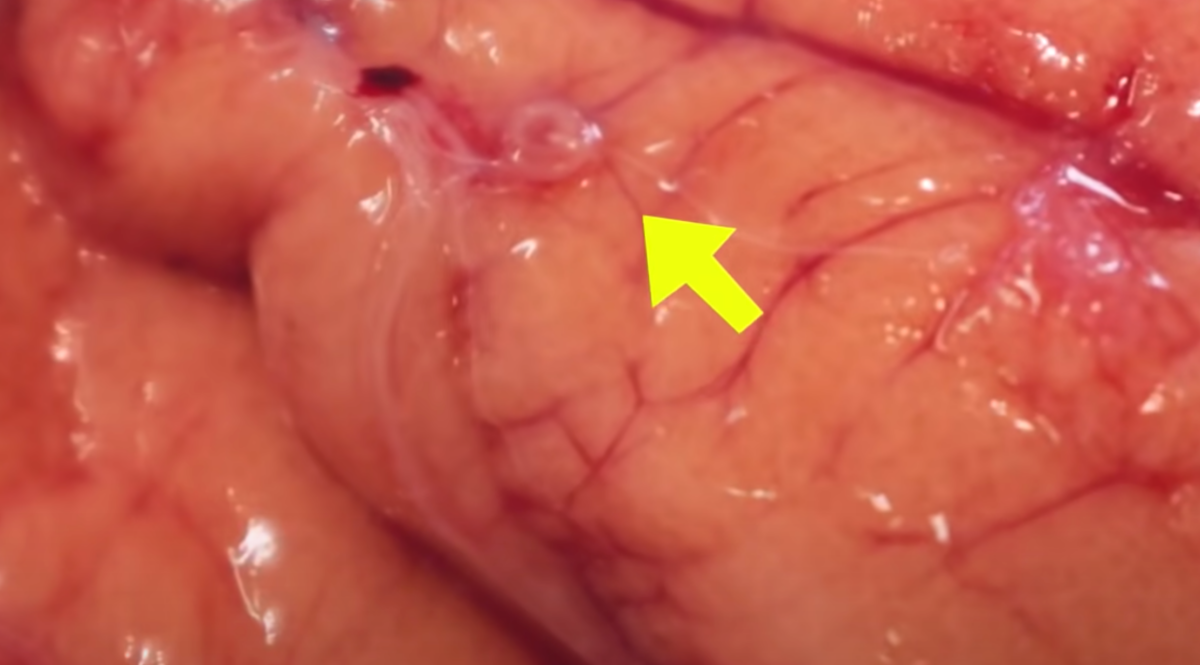 생선-알-고래회충