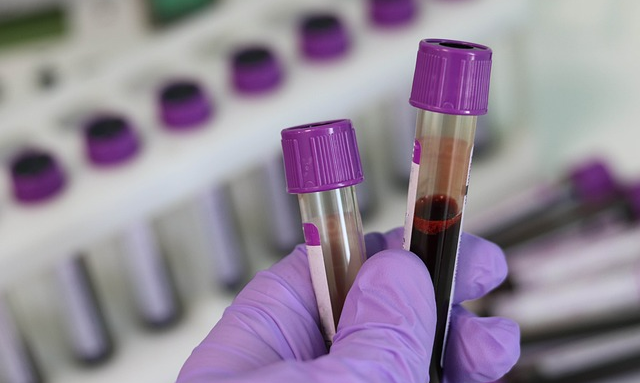 종양 표지자 검사