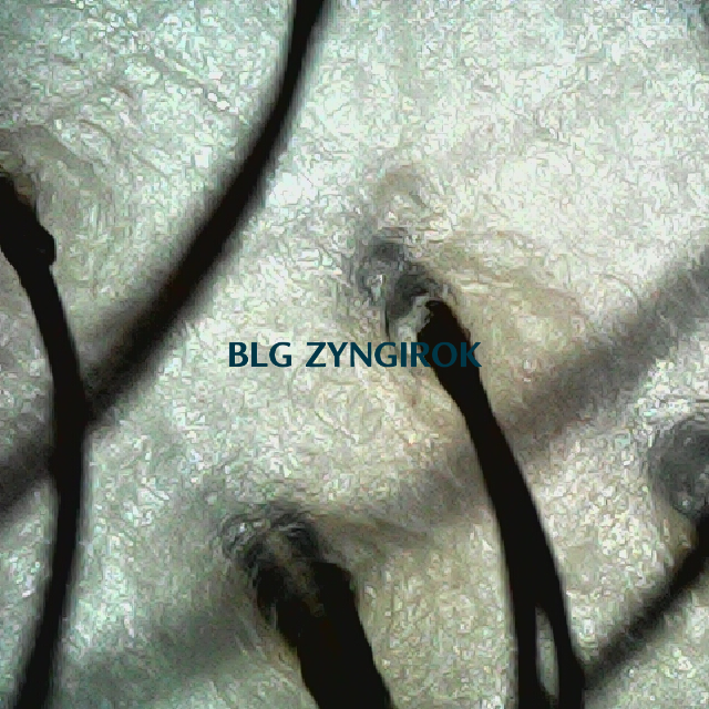 탈모 극복 프로젝트 - 뒷머리 두피 모습이다.