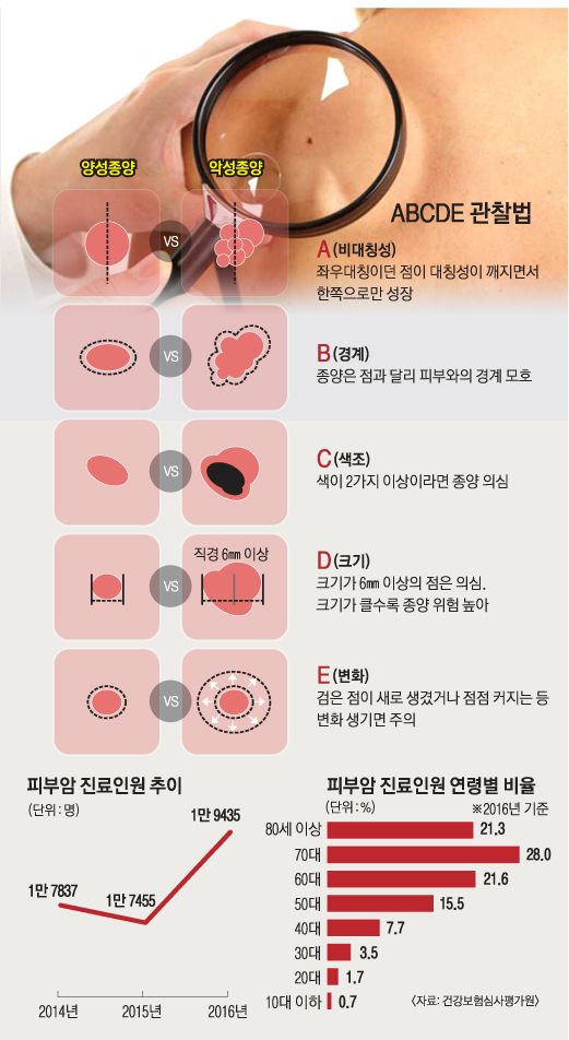 피부암