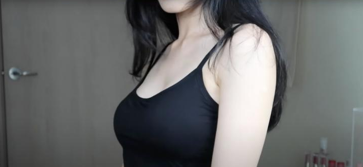유깻잎 성형