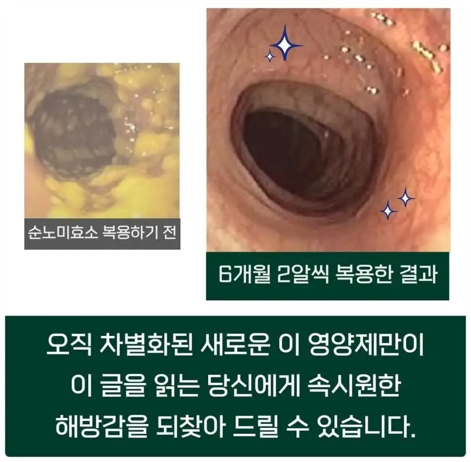 췌장효소추천