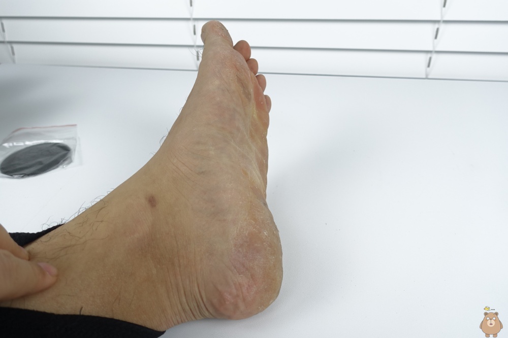 스크린 각질 제거기, 원형 사포 스타일