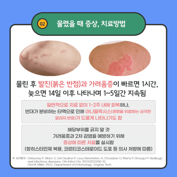 물렸을때 증상