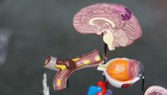 치매 초기증상 8가지 