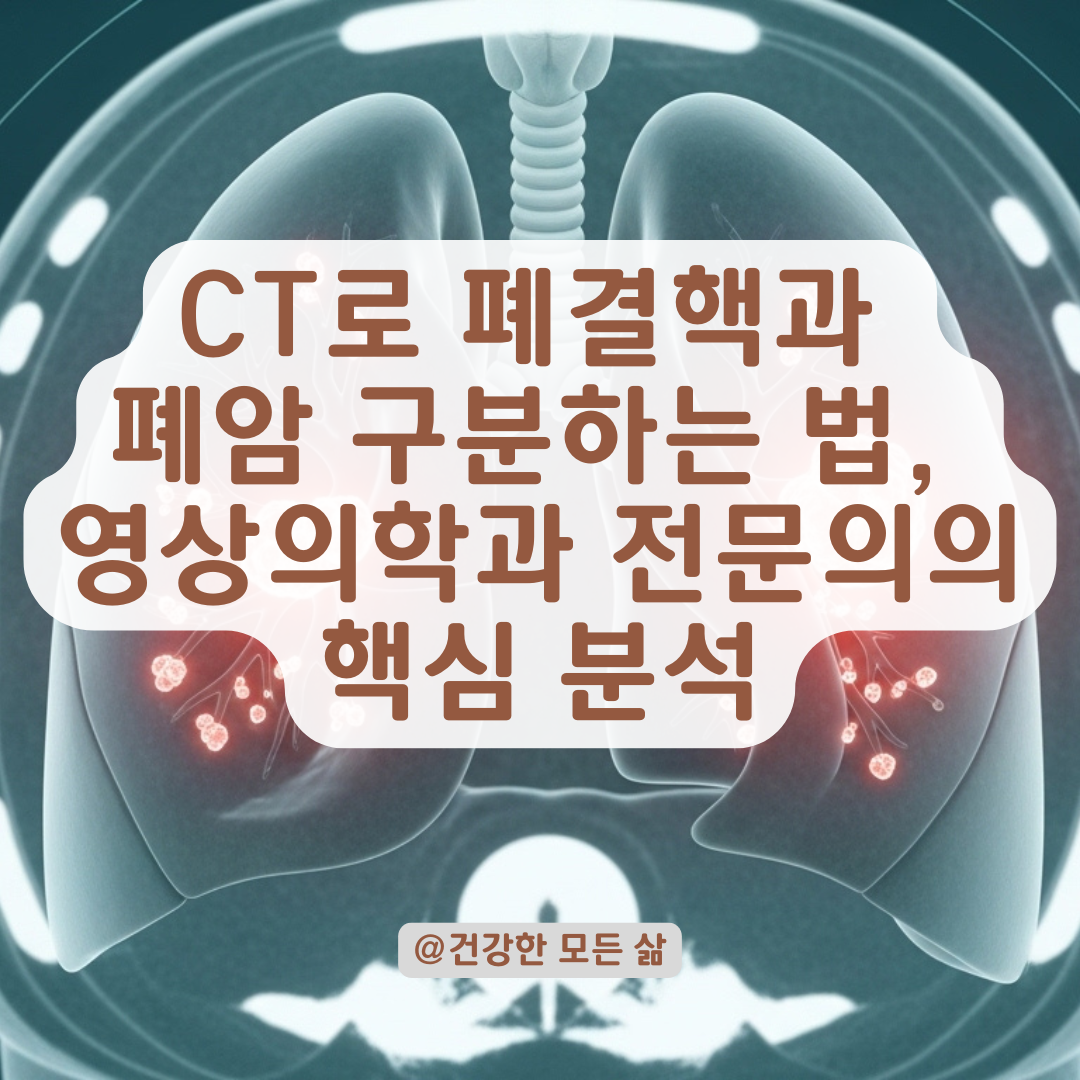 CT로 폐결핵과 폐암을 구분할 수 있는 이유, 영상의학과 전문 시선에서 분석.