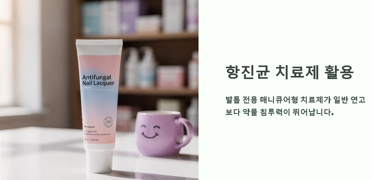 발톱무좀 없애는 방법