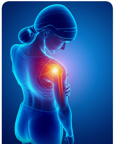 어깨충돌증후군-원인