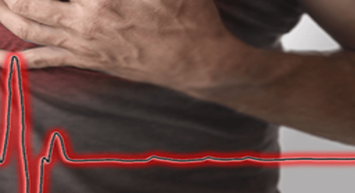 고지혈증증상흉통