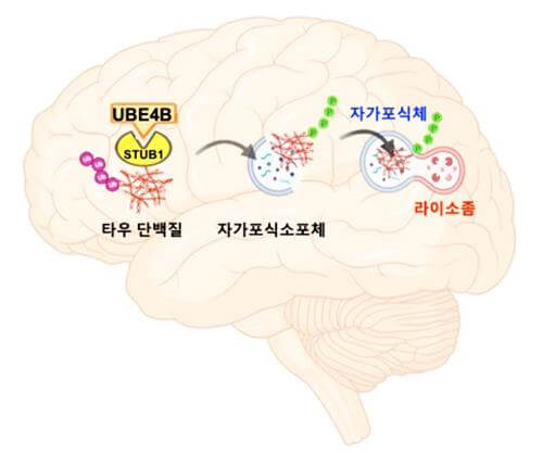 알츠하이머 치료제 최신 정보와 미래 전망