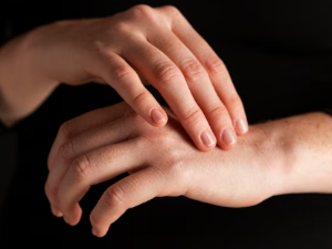 손이 붓는 이유