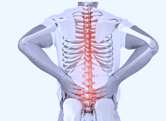 좌골신경통과 허리 통증 관계