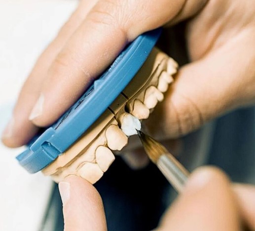 임플란트-어금니-앞니-가격