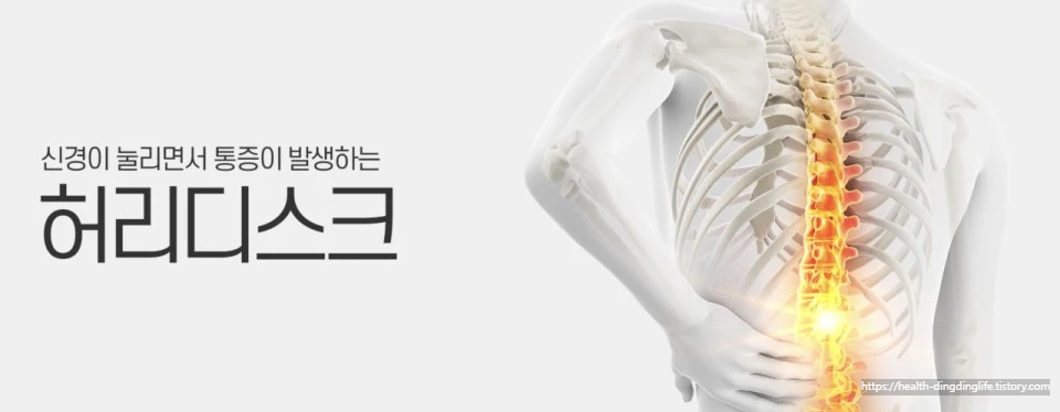 허리디스크 이미지