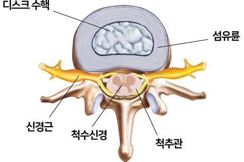 디스크