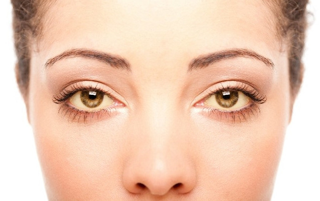 간이 안좋을때 나타나는 증상