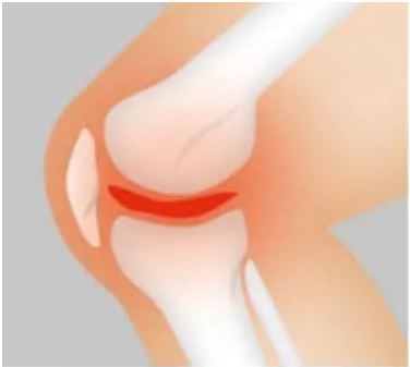 콘드로이친-효능