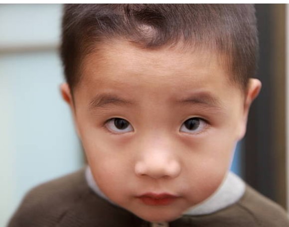 모발의 종류와 형태-cowlick