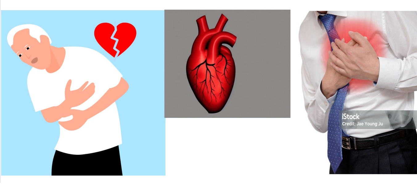 협심증(심근경색)