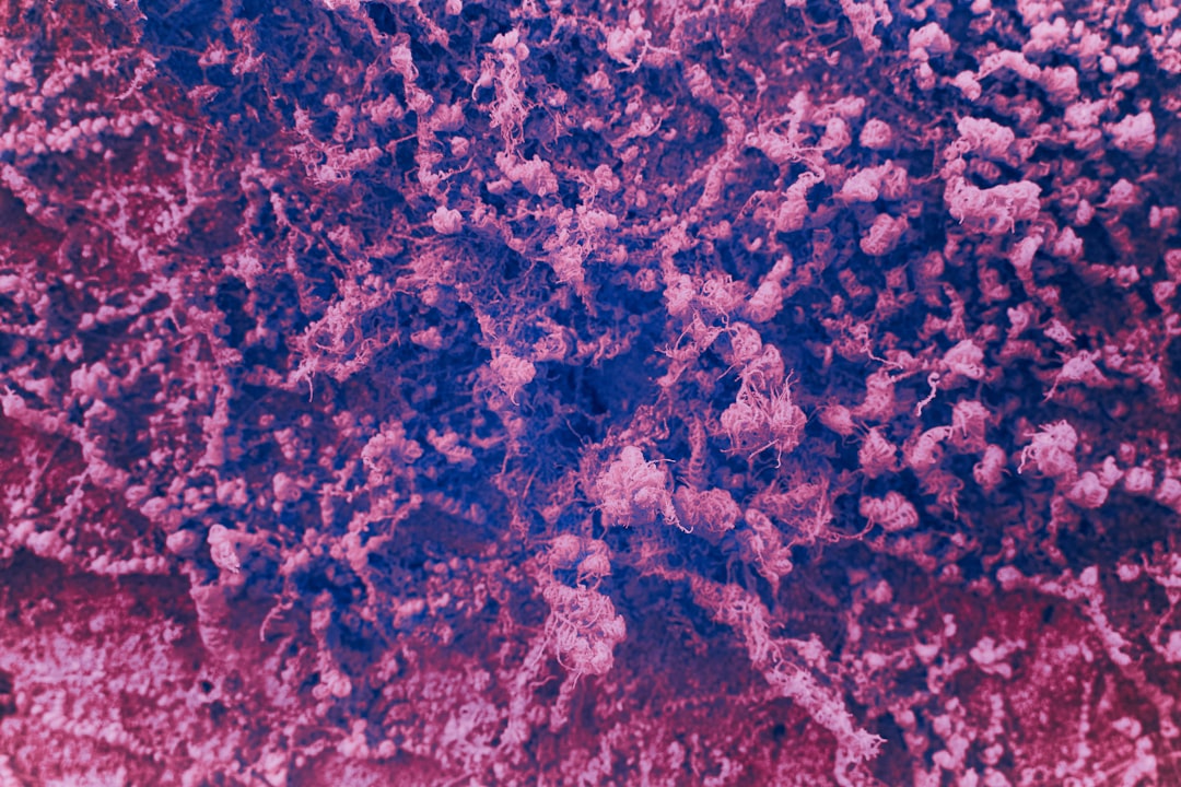 Seborrhea