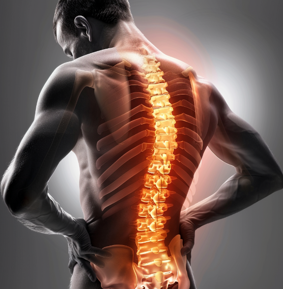 허리 삐끗했을 때