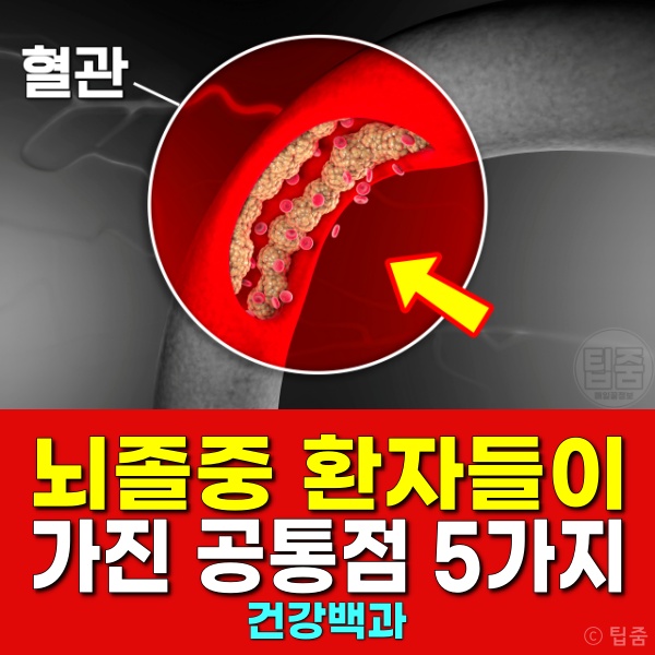 뇌졸중 환자 공통점 복부비만 중성지방 콜레스테롤 혈당 고혈압
