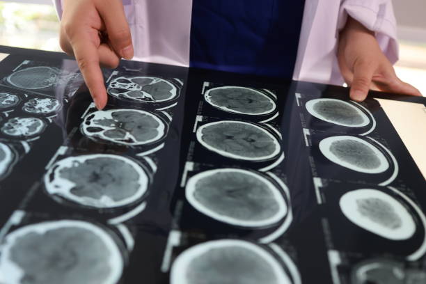 뇌졸중 초기증상일 가능성이 높습니다 시야 흐림과 함께 이런 증상이 있다면 시간을 지체하지 말고 즉시 응급실로 이동