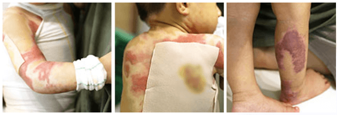 고통스러운 은우2