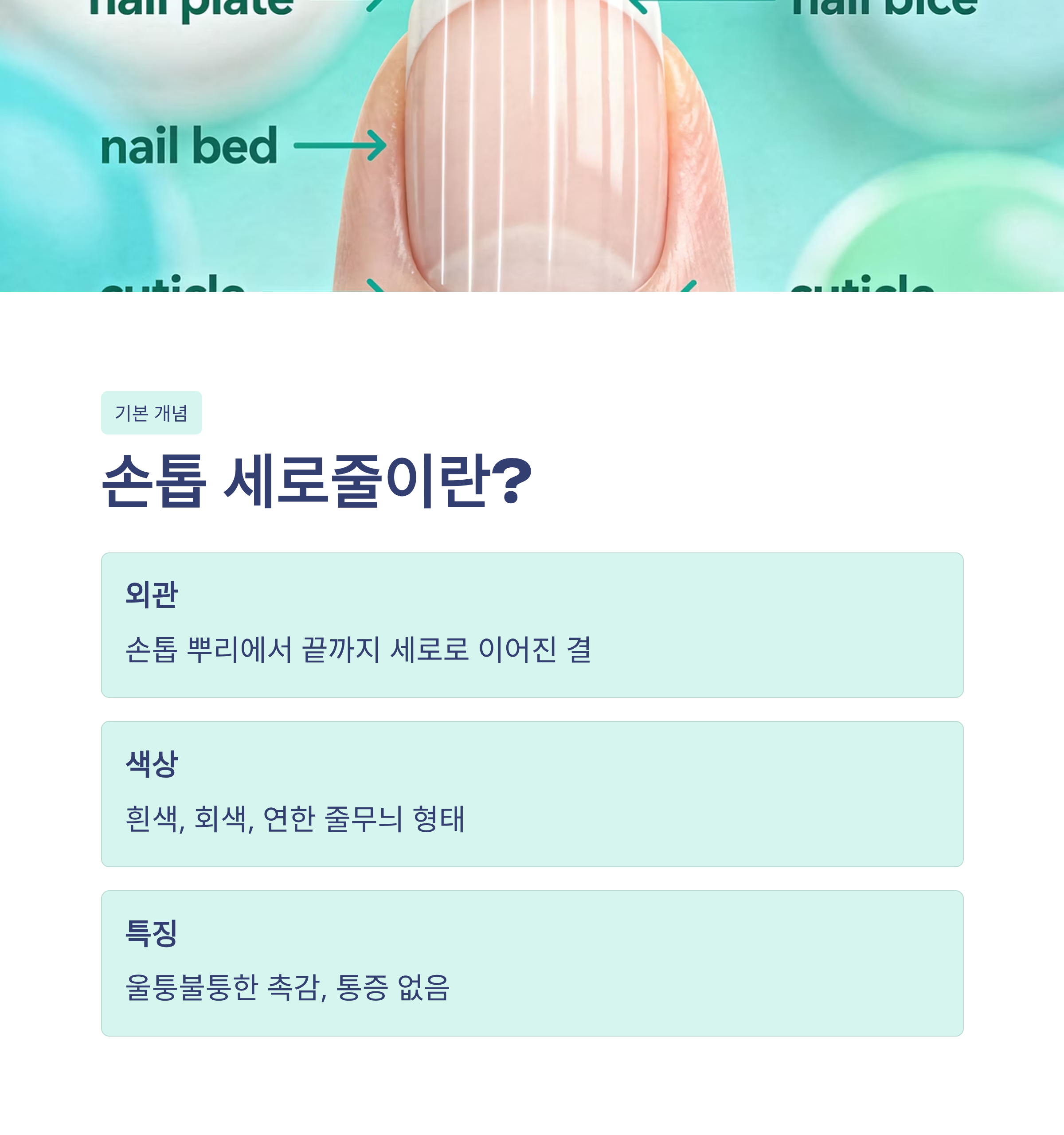 손톱 세로줄