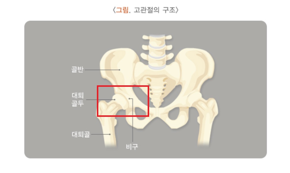 고관절 통증 증상 알아보기