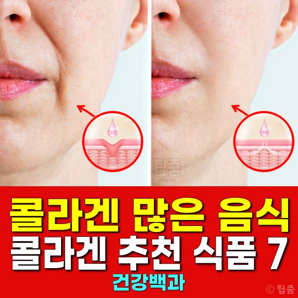 콜라겐 많은 음식 콜라겐 추천 식품 피쉬콜라겐 효능