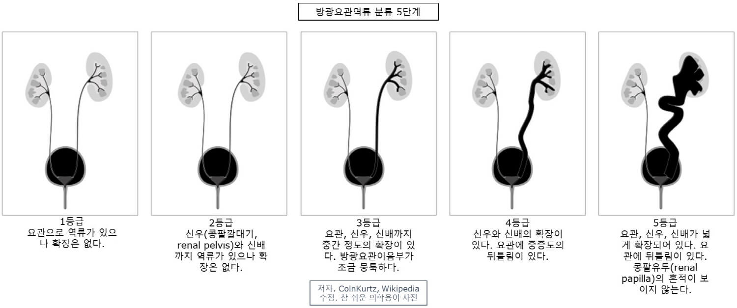 1~5등급