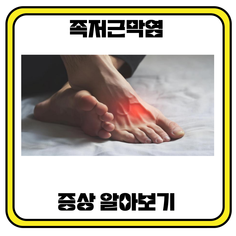 족저근막염 증상