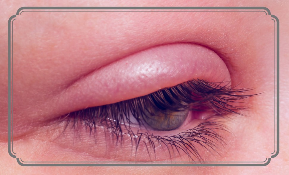 염증에 좋은 음식